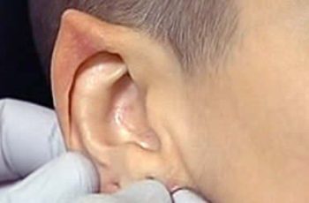Elf ears the latest trend