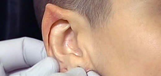 Elf ears the latest trend